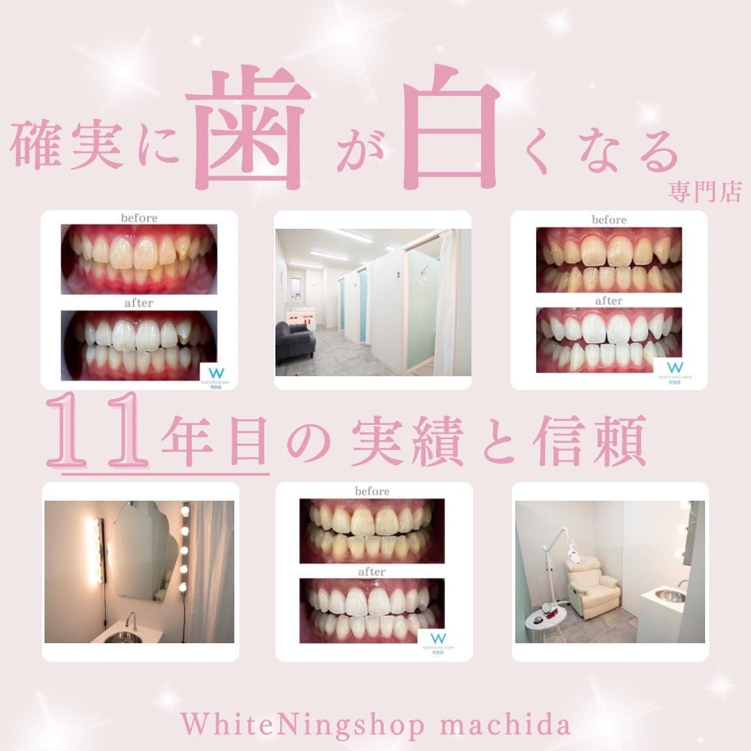 ホワイトニングショップ町田店