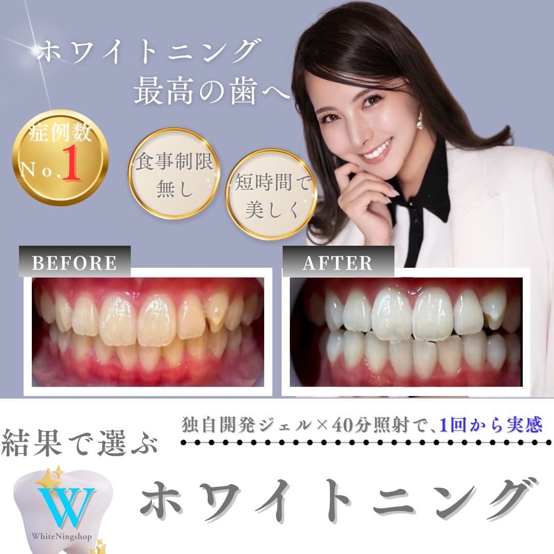 ホワイトニングショップ町田店